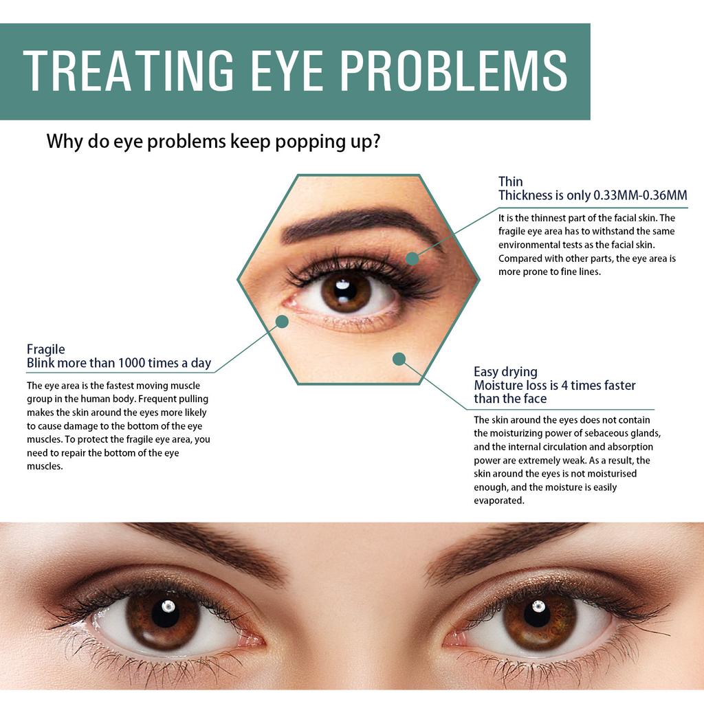 Крем для кожи вокруг глаз против морщин EELHOE Уход за кожей вокруг глаз Уменьшает появление темных пятен Сухие морщины Мелкие морщины Укрепление и восстановление