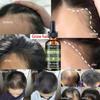 New Hair Care Hair Growth Essential Oils Nutrient Solution Hair Loss Treatment Hair Care Conditioner