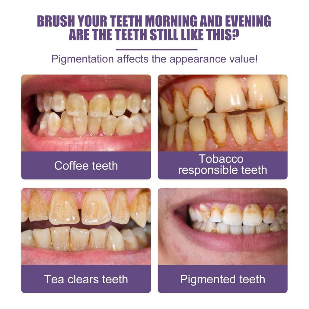 Порошок для отбеливания зубов обладает отбеливающим эффектом, эффективен при глубоких пятнах и может быстро отбелить чистящий порошок для зубов.