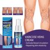 30 мл спрей для массажа варикозных вен снимает дискомфорт в ногах улучшает кровообращение мягкий эффективный спрей для варикозного расширения вен