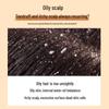 ZIYUAN Anti-Dandruff & Oil Control Shampoo