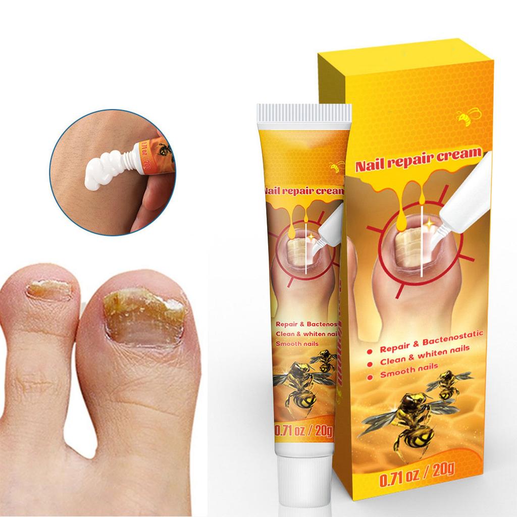 Nail Cream, Cleans And Smoothes Nails, Repairs Damaged Nails, Strengthens Nails, Promotes Nail Health, Nourishes And Moisturizes The Skin