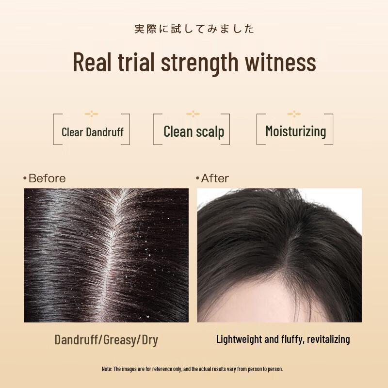 Dieyin Anti-Dandruff & Anti-Itch Shampoo 4x600ml