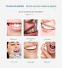 Portable Electric Water Flosser for Teeth Cleaning