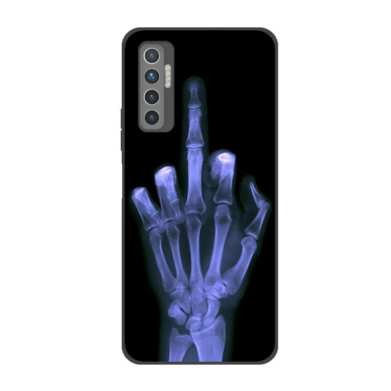 For Tecno Camon 17P Case Soft Silicone For Tecno Camon 17P Casing Painted TPU Back Cover