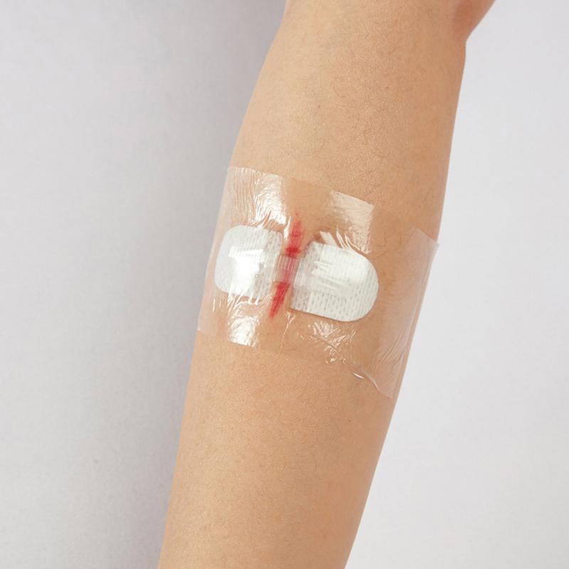 Стерильная полоска для удаления шрамов, следов от угревой сыпи, стерильный пластырь для первой помощи, дорожный хирургический пластырь для закрытия ран