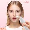 3 Suction Mode Electric Blackhead Remover 5 Suction Heads Face Cleansing Machine  Spot Acne