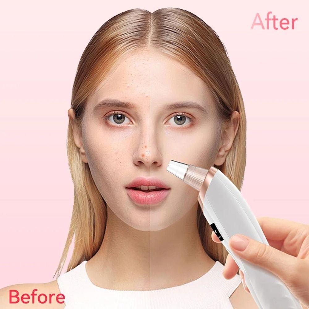 3 Suction Mode Electric Blackhead Remover 5 Suction Heads Face Cleansing Machine  Spot Acne