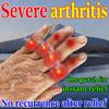 Herbal Patch for Rheumatoid Arthritis - Soothes Joint Swelling Safe for Sensitive Skin