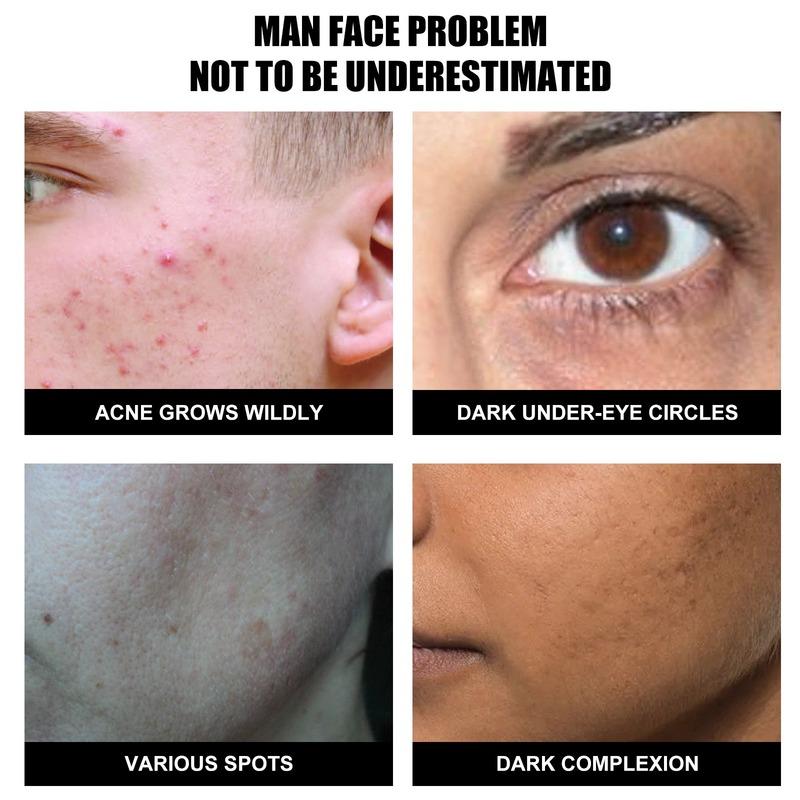 Men's Plain Cream, Refreshing, Concealer Spots, Acne Marks, Whitening, Moisturizing and Isolating Face Cream, Moisturizing and Brightening Skin