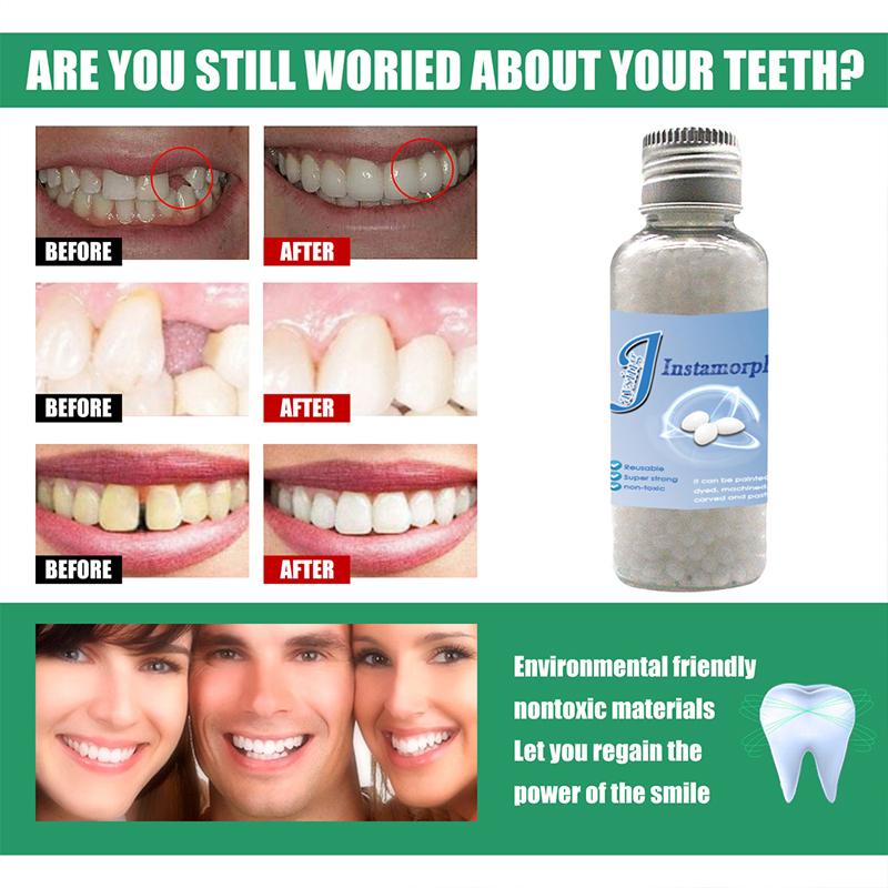 Film And Television Make-Up Dentures Modification Temporary Filling Teeth Glue False Filling Tooth Gap Filling