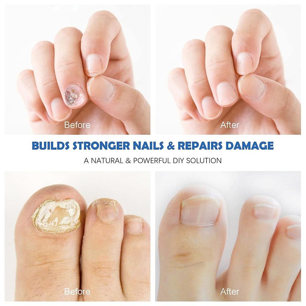 Жидкость для маникюра защищает руки и ногти\5мл