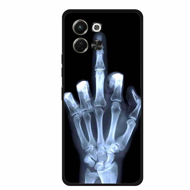 For Tecno Spark 30 5G Case Spark30 5G Cover Soft Silicon Back Cover Phone Case for Tecno Spark 30 5G Cases Soft Fundas Spark 30