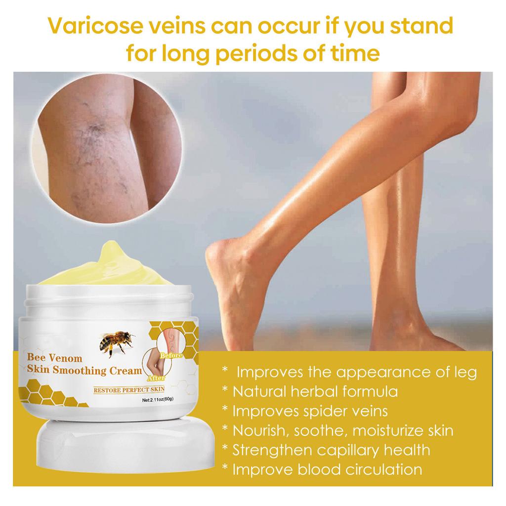 Venoheal Varicose Vein Ease Paste, Varicose Veins Paste, Varicose And Spider Veins Ease For Legs, Improve Blood Circulatio
