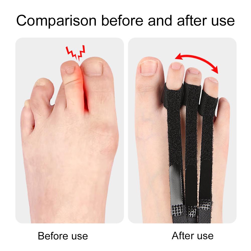Регулируемый разделитель пальцев ног, инструмент для регулировки перекрытия пальцев ног, разделитель пальцев ног для мужчин и женщин