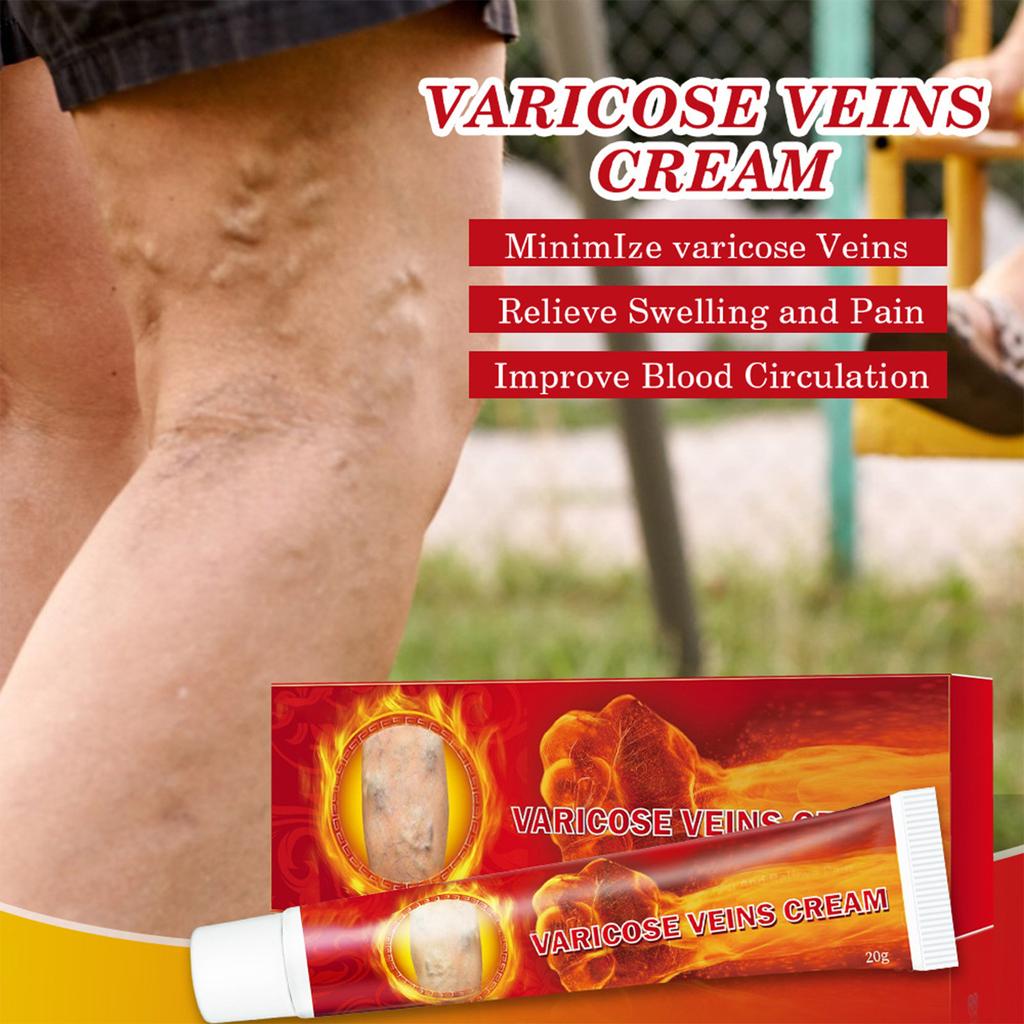 2pcs Health Cream For Relieving Varicose Veins, External Ointment For Vasculitis, Blood Circulation, Varicose Veins