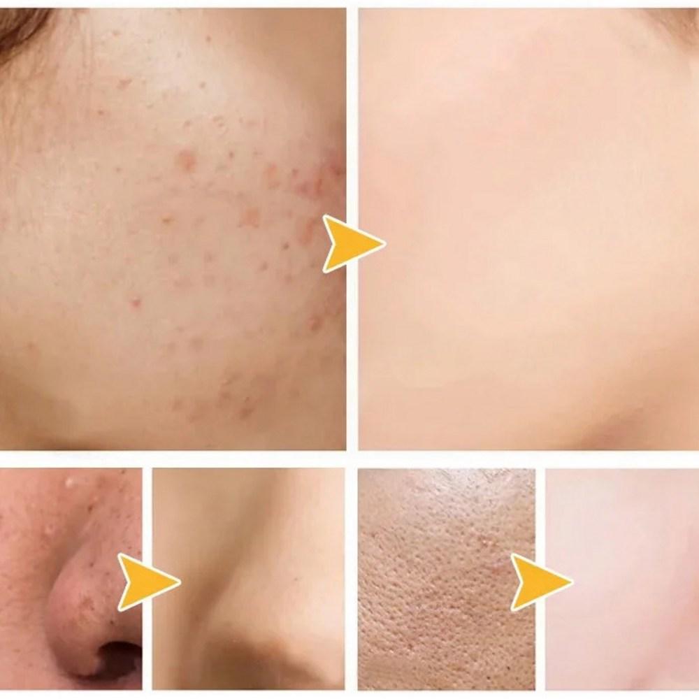 Очищение + увлажнение, двухцветная грязевая маска, 1 упаковка