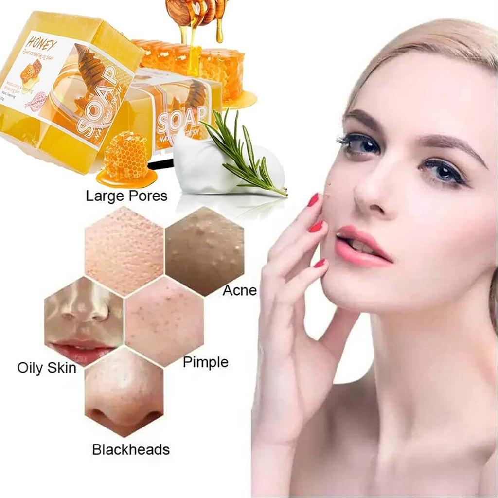 Honey Soap Bar, Organic Natural Honey Soap Bar For Dark Spots And Acne For All Skin Types