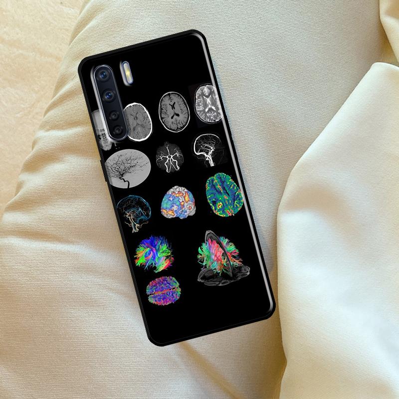 Anatomy Brain Case For Oppo A6 A5 Pro A15 A57 A17 A54 A74 A94 A76 A16 A96 A40 A60 A80 A18 A38 A58 A78 A98