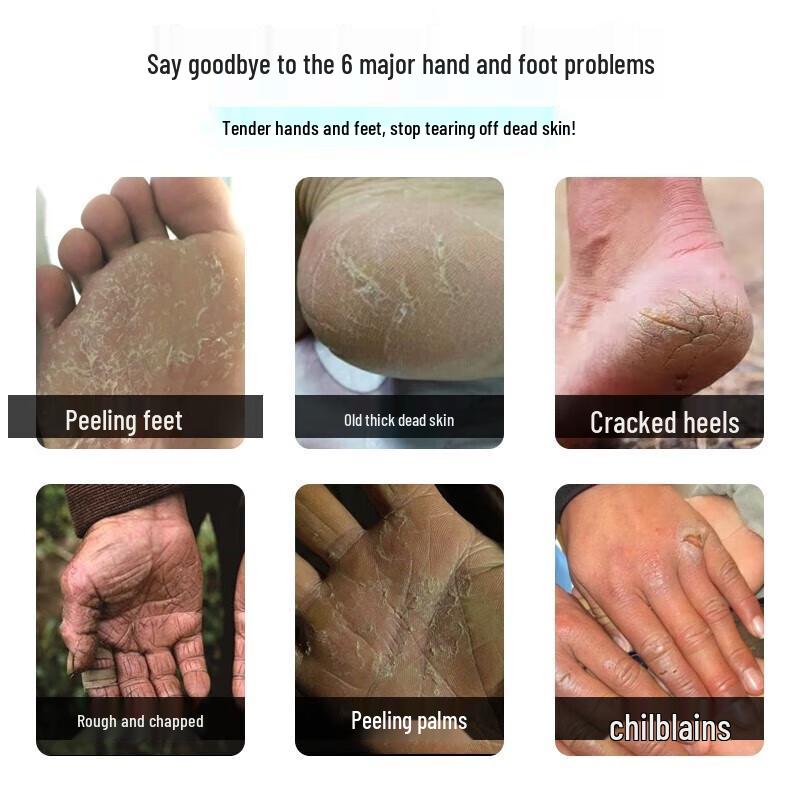 Longliqi Snake Oil Hand & Foot Repair Cream