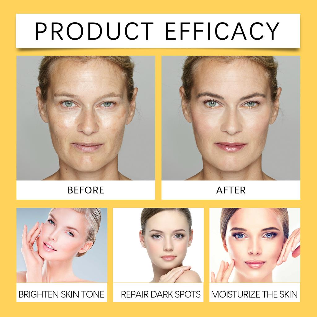 Ниацинамид Увлажняющий уход за кожей лица Глубокое осветление Устранение следов от акне Пятна Увлажнение Ингибирование меланина, 30 мл