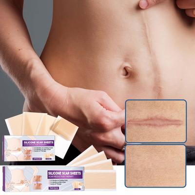 Fade C-section Smooth Skin Силиконовый пластырь для ухода за кожей