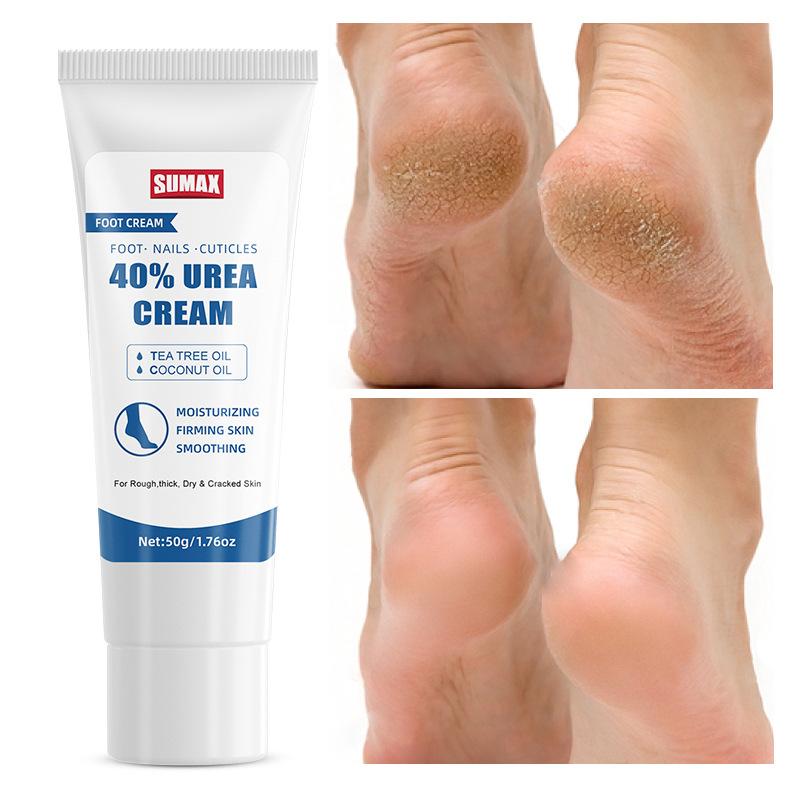 Крем для ног Advanced Urea 50 г. Профессиональное увлажняющее средство для сухих ног и потрескавшихся пяток