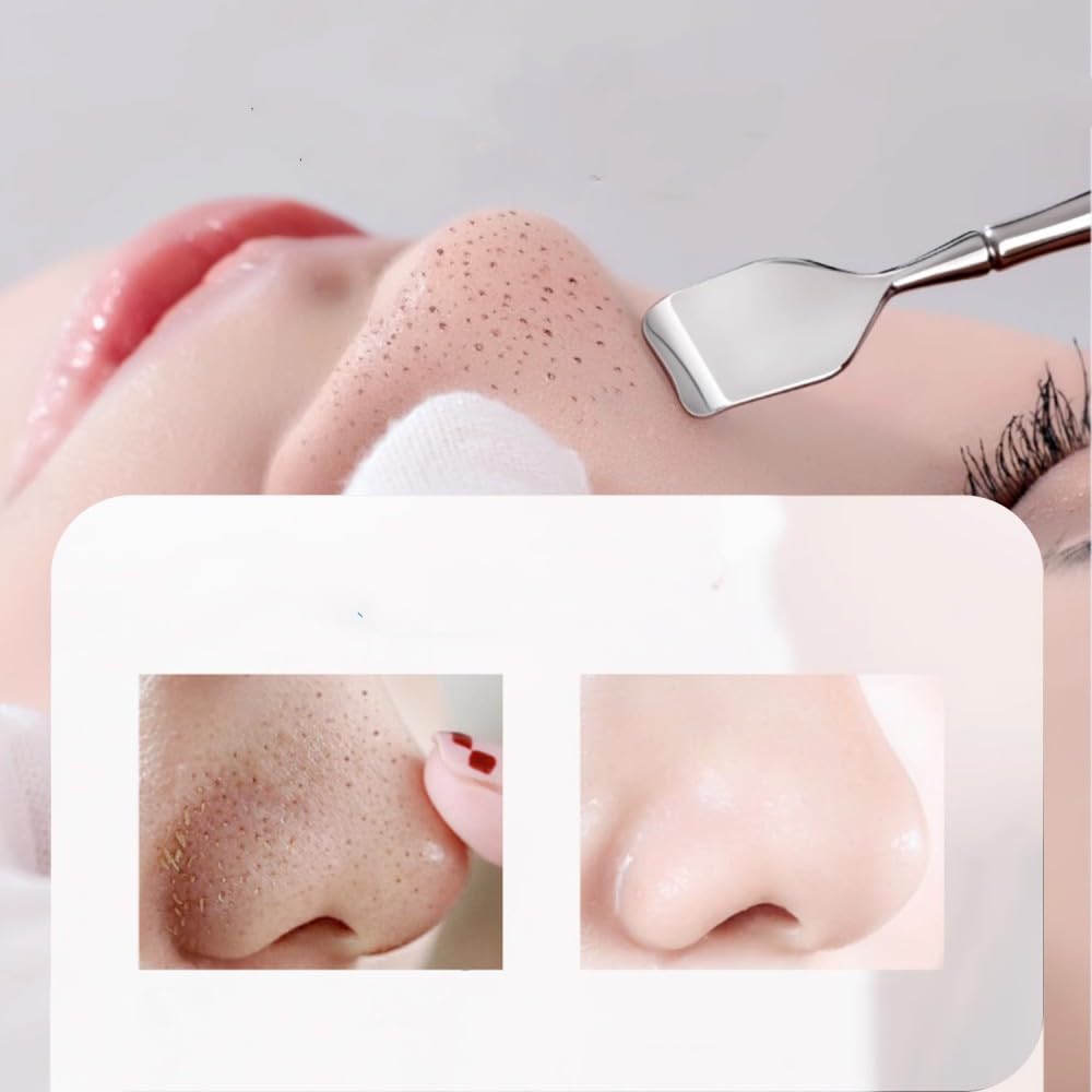 2 Pieces Stainless Steel Acne Nose Pore Cleaning Metal Pore Facial Massage Beauty Blackhead Cleaning Ideal for Women Spatula, Tool, Extractor, Tool,