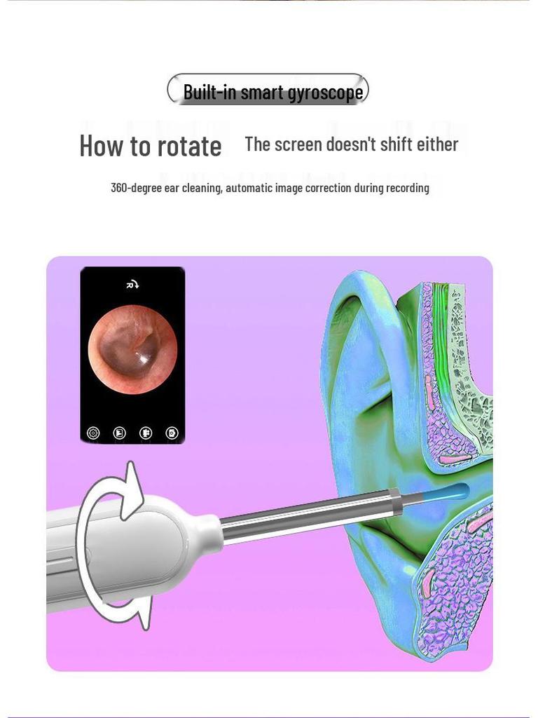 HD Wireless Ear Cleaning Tweezers with Visual Scoop & WiFi Connection