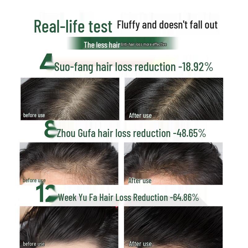 Hexin Шампунь против выпадения волос и для роста волос