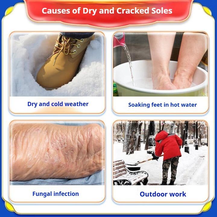 Специальный крем от трещин на руках и ногах, сухости и трещин на пятках, сухости и трещин, грибковой инфекции, трещин от обморожения