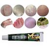 15g Herbal Ointment Antibacterial Relieve Itching Skin Problems Treatment Cream