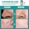 Disunie Bamboo Charcoal Blackhead Removal Nose Patch Увлажняющая очищающая поры маска для носа от прыщей Пластырь для носа
