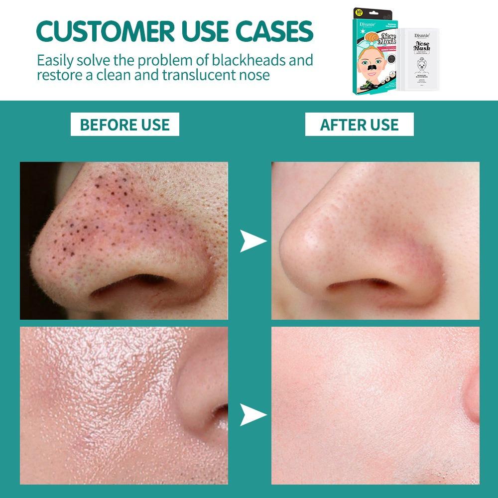 Disunie Bamboo Charcoal Blackhead Removal Nose Patch Увлажняющая очищающая поры маска для носа от прыщей Пластырь для носа
