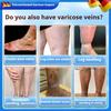 Clinically Tested Vein Cream | Reduces Swelling & Discomfort from Varicose Veins