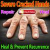 Крем для заживления кожи, успокаивающий, восстанавливающий, подходит для потрескавшегося кератина, потрескавшихся рук, ног, зуда
