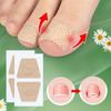 Nail Fungus Treatment Patches Repairing and Improving Appearance of Damaged Discolored and Thick Nails Toenail Fungus Removal Tools