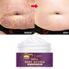 Remove Scars - Pregnancy Cream - Fade Fine Lines - Postpartum Lines, Tighten the Skin, and Make the Skin Elastic