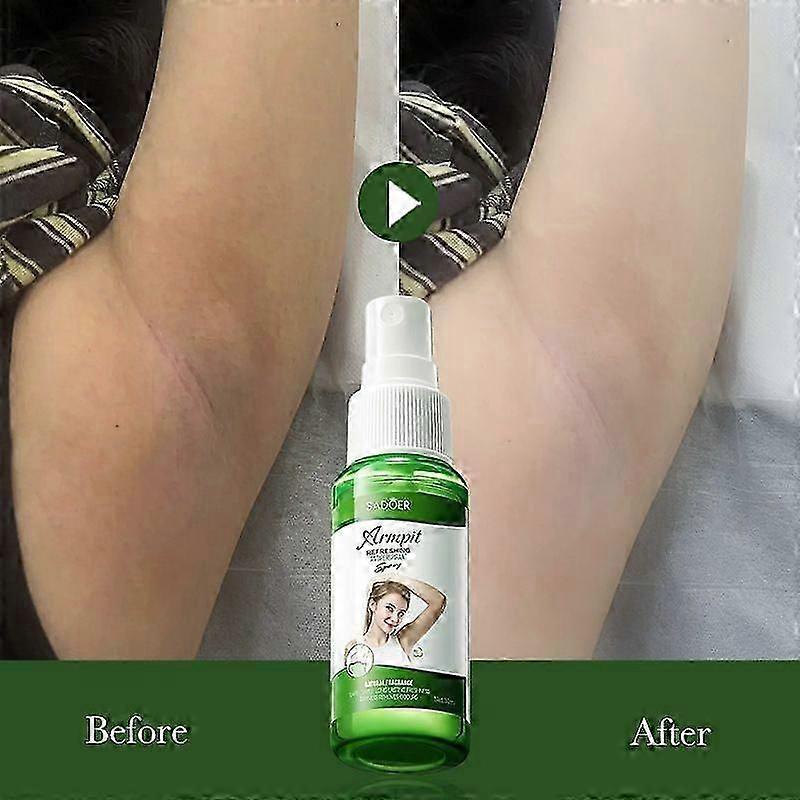 Strong Deodorant for Excessive Sweating Treatment,Deodorant Womens,Deodorant for Men,Mens Deodorant Spray,Natural Deodorant,Women Deodorant Spray