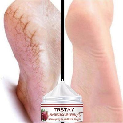 Ремонт трещин, удаление мозолей, уход за омертвевшей кожей, маска против сухости, отшелушивающие носки, уход за ногами, уход за ногами