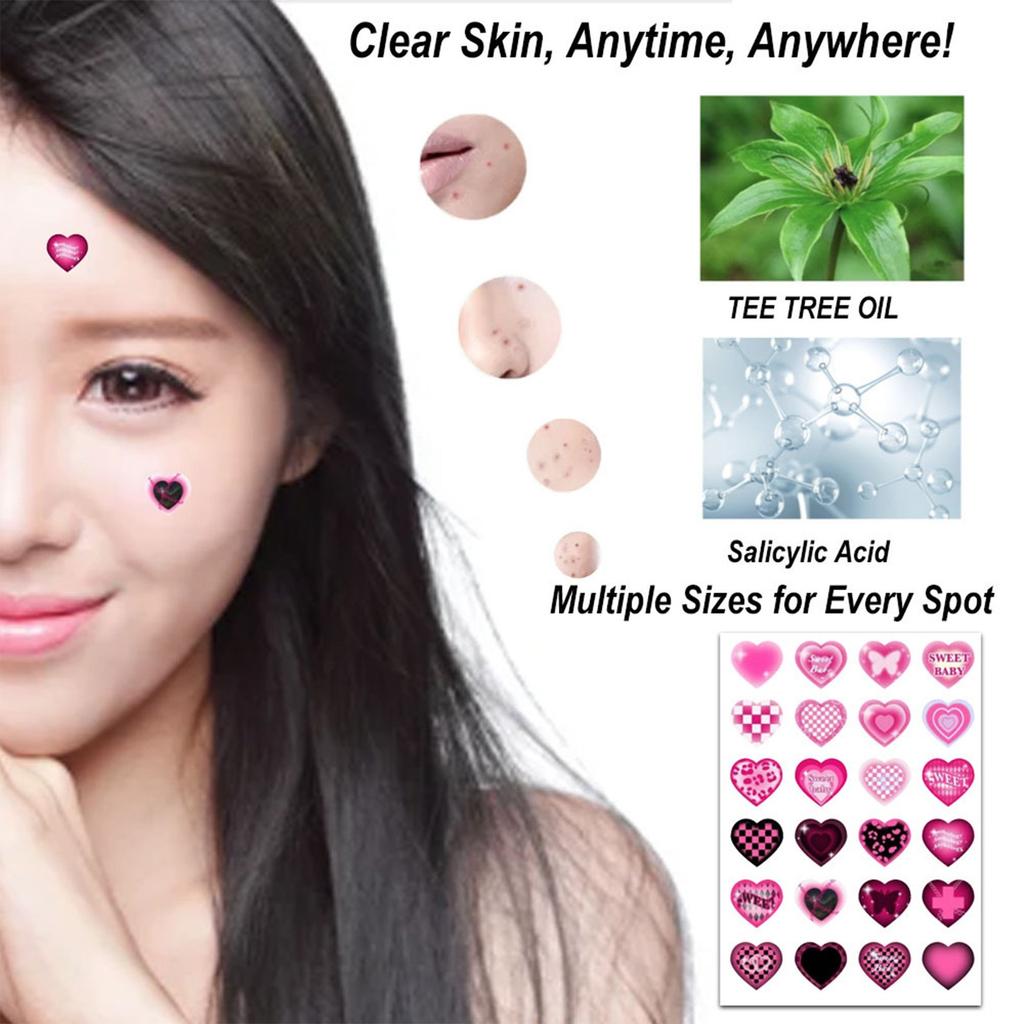 Пластыри от прыщей большой емкости, симпатичные покрытия от прыщей, гидроколлоидные пластыри от прыщей с гиалуроновой кислотой 96 шт.