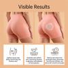 Curve Sculpt Micro-Patch Buttocks Enhancement Patch Sculpting Firming Smoothing Lower Body Curves For Body Shaping For Daily Use