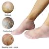 Health Care Moisturizing Socks Anti-slip Skin Care Anti‑Cracking Short Elastic Beach Socks