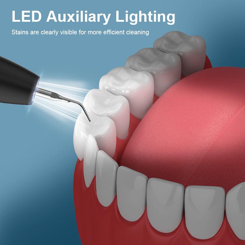 Интеллектуальный ультразвуковой очиститель зубов Стоматологический скалер 3 режима очистки Быстрая зарядка Частота 2 миллиона Удаление зубного камня Уход за деснами