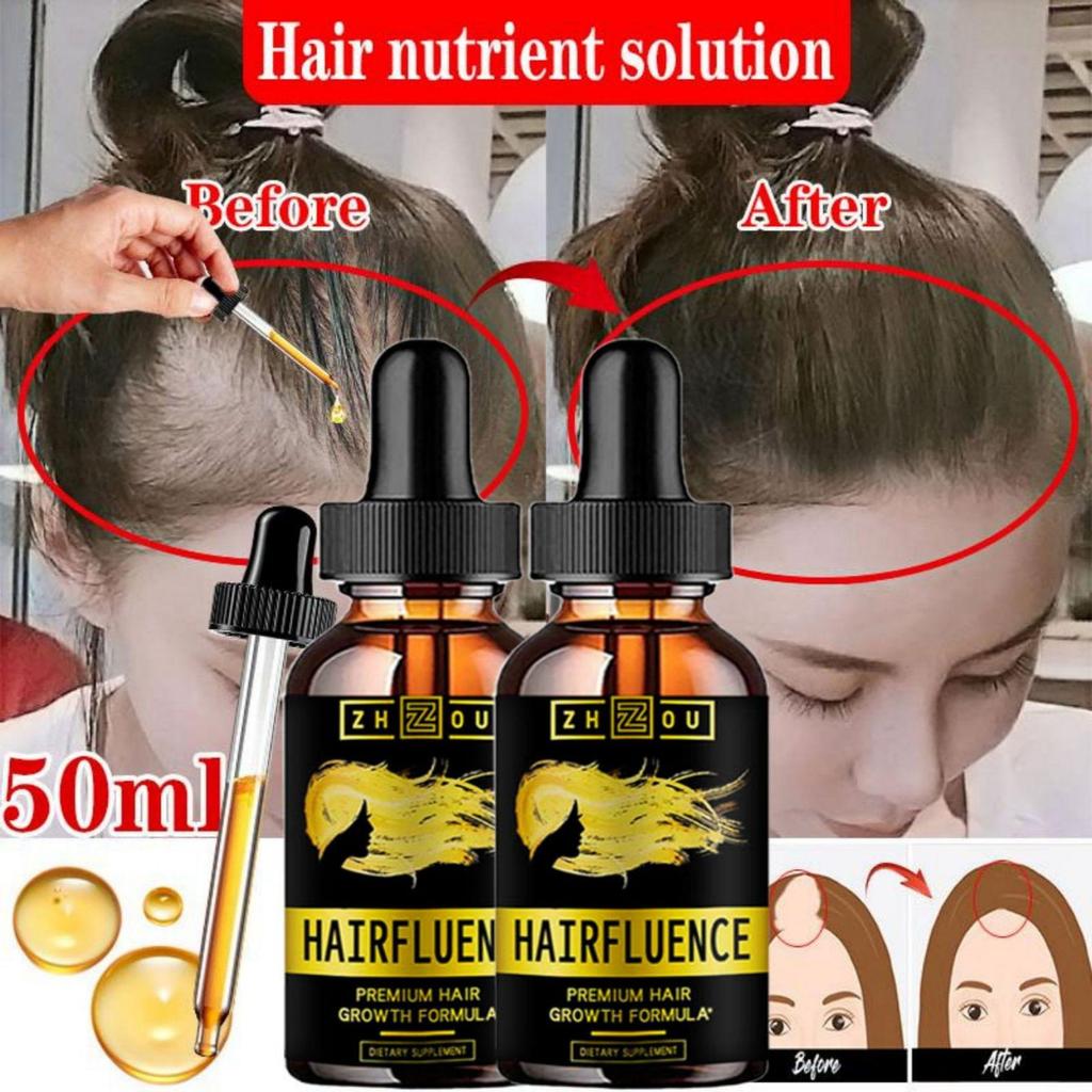 5 мл/15 мл/30 мл/50 мл/сыворотка для роста волос продукт по уходу за волосами сыворотка для волос быстрые волосы
