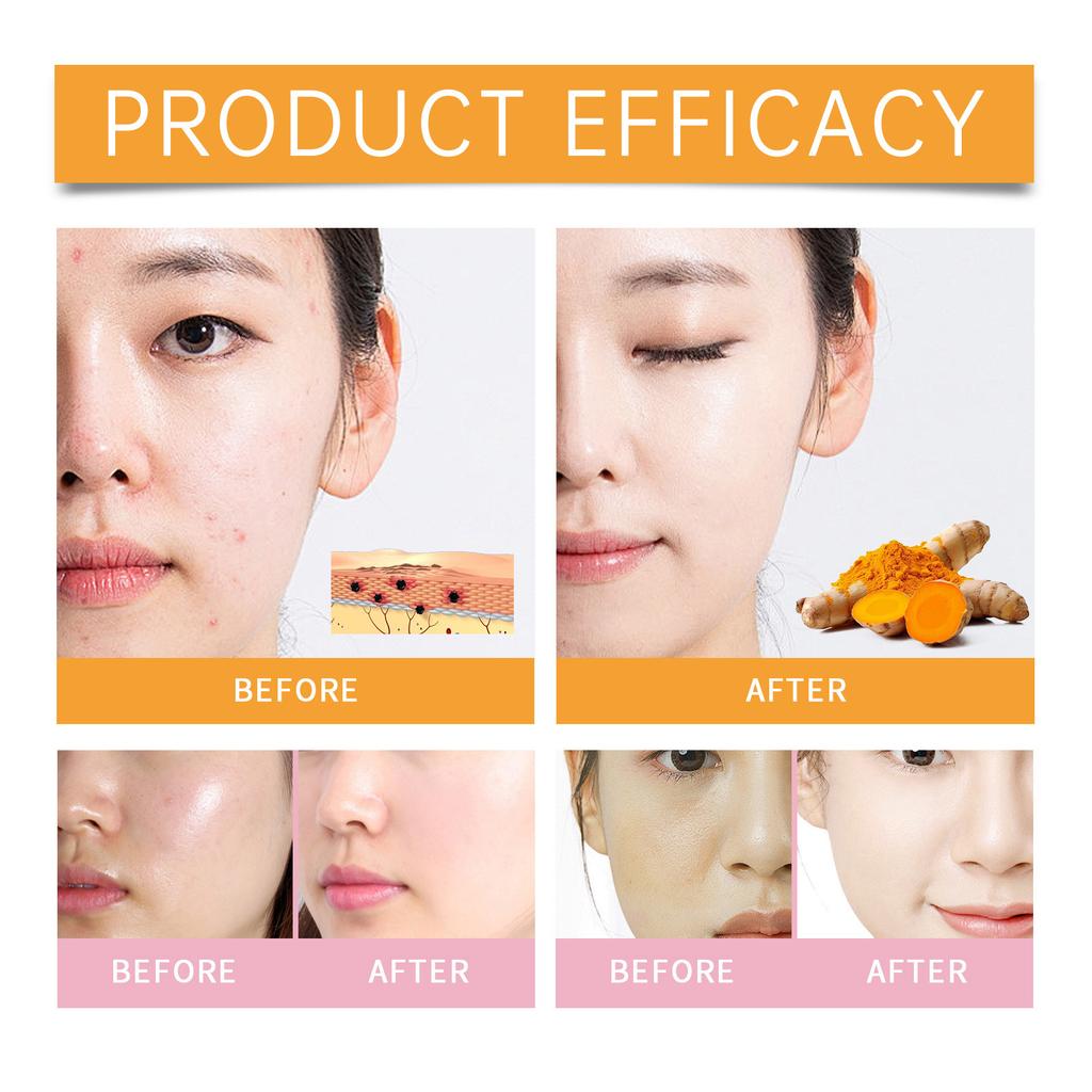 Whitening And Rejuvenating Cleansing Mousse; Cleansing Milk; Whitening Facial Cleanser 100ml