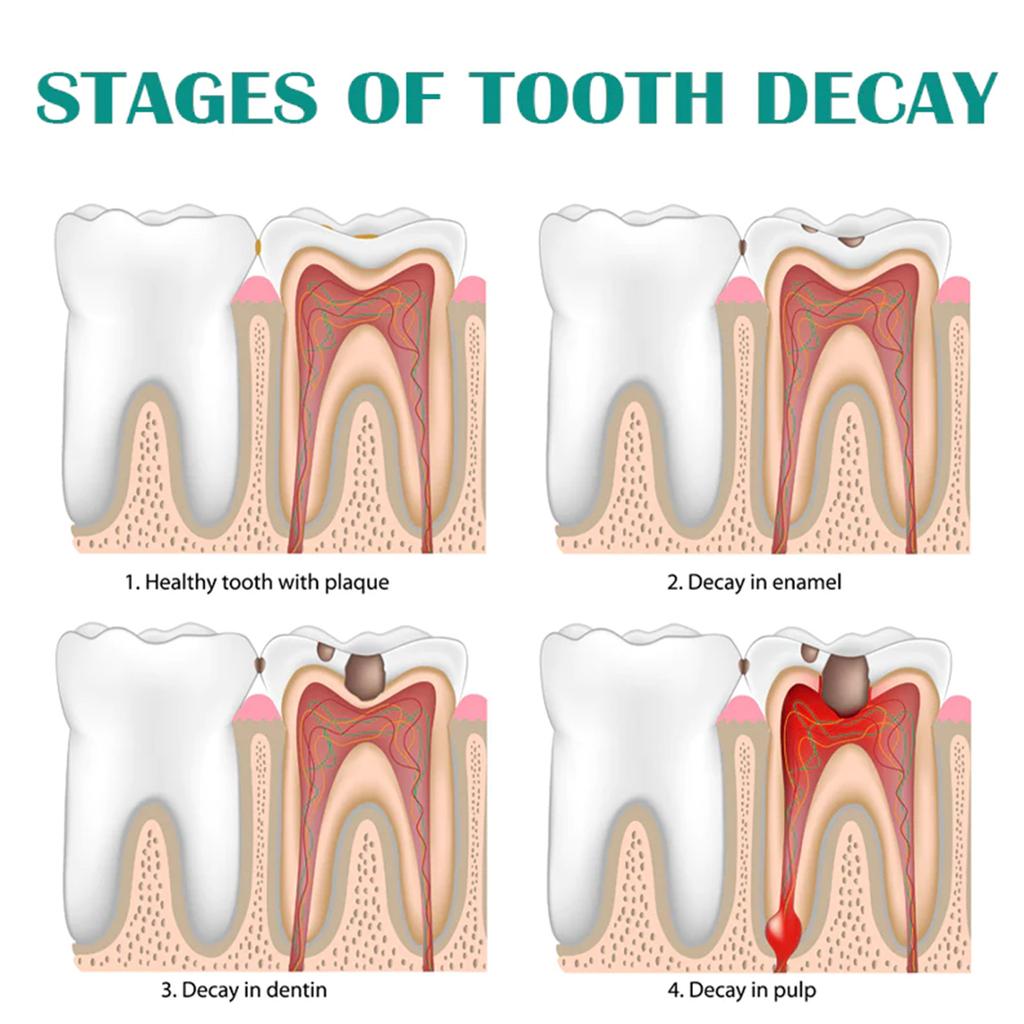 EELHOE Очищение зубов, отбеливающий мусс, зубная паста для глубокой очистки, пена, зубная паста удаляет пятна, свежее дыхание, инструменты для ухода за зубами, 30 мл