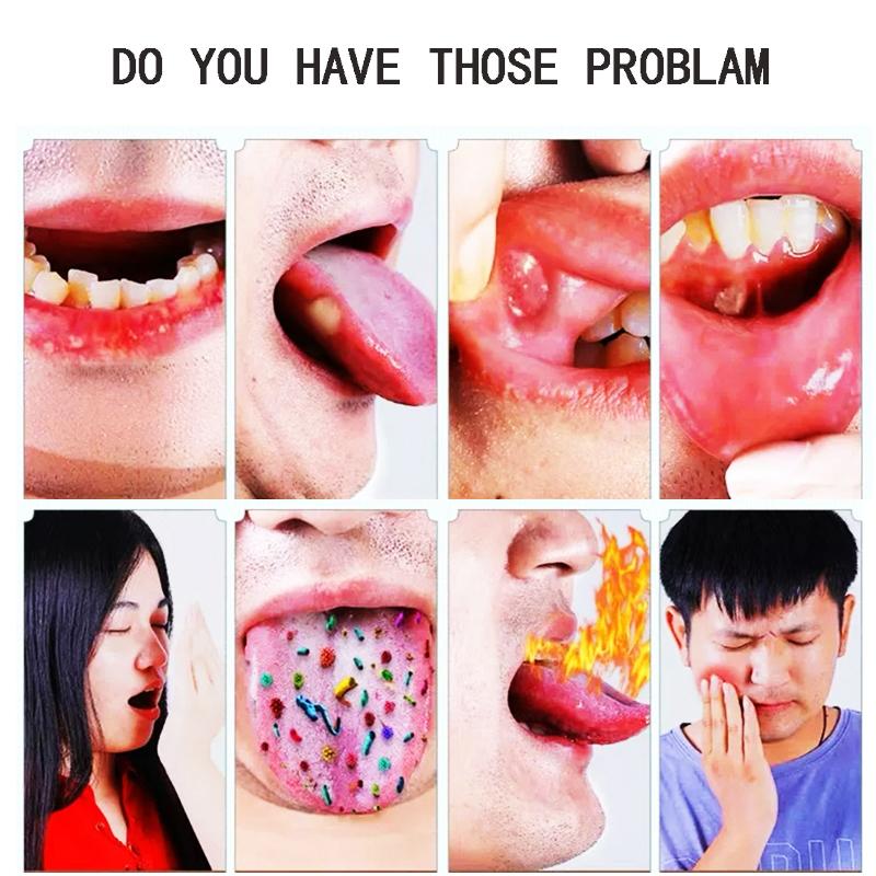 20 мл Спрей для полости рта с прополисом для свежего дыхания и ухода за полостью рта