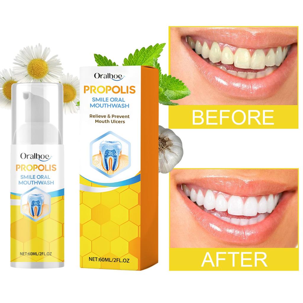 Ополаскиватель для рта с прополисом, ополаскиватель для рта с пчелиным прополисом, ополаскиватель для рта с прополисом, зубная паста с прополисной пеной, полный уход за зубами(60мл)