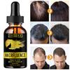 5 мл/15 мл/30 мл/50 мл/сыворотка для роста волос продукт по уходу за волосами сыворотка для волос быстрые волосы